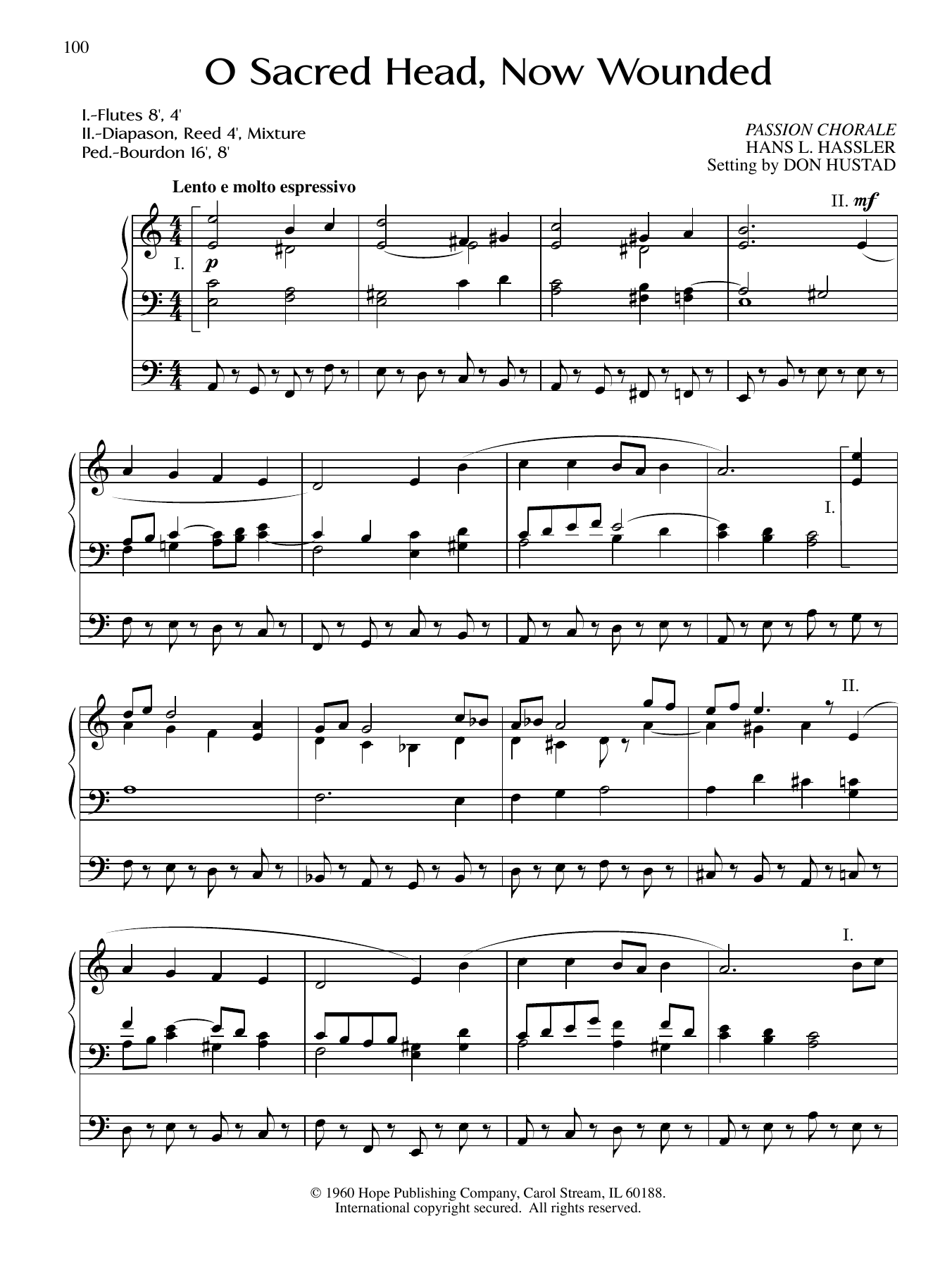 Learn to play Don Hustad O Sacred Head, Now Wounded sheet music for Organ in minutes. Price: 6.9900$ Don Hustad O Sacred Head, Now Wounded sheet music notes and chords arranged for Organ