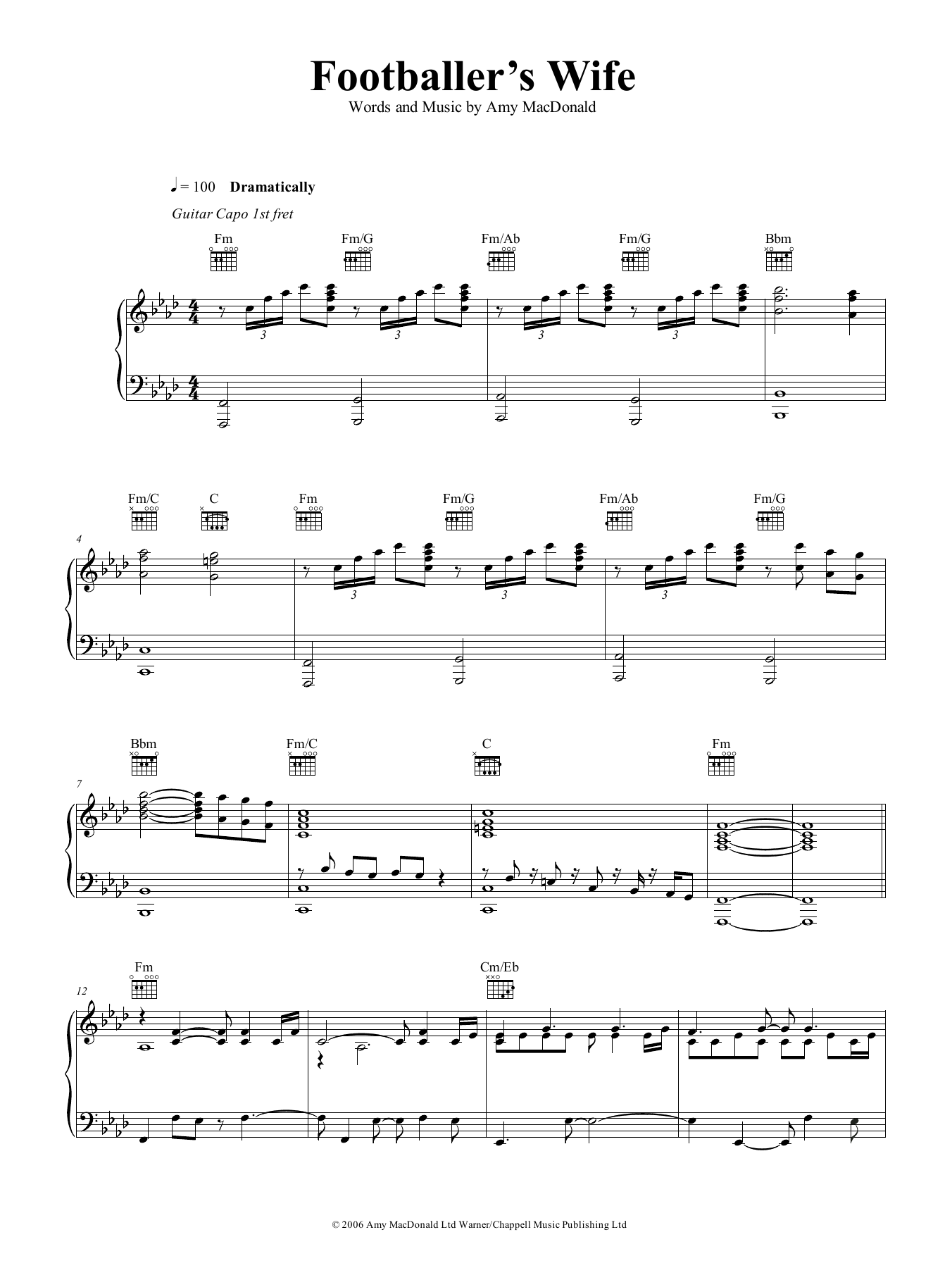 Learn to play Amy MacDonald The Footballer's Wife sheet music for Piano, Vocal & Guitar Chords (Right-Hand Melody) in minutes. Price: 6.9900$ Amy MacDonald The Footballer's Wife sheet music notes and chords arranged for Piano, Vocal & Guitar Chords (Right-Hand Melody)