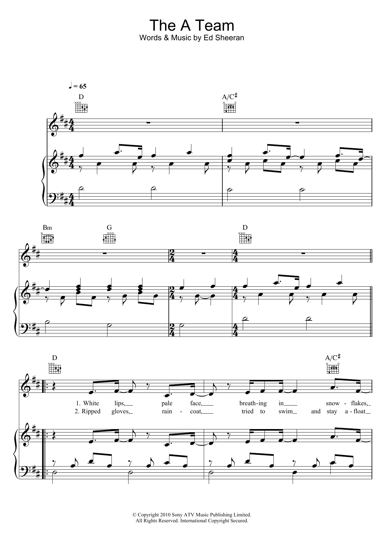 Learn to play Birdy The A Team sheet music for Piano, Vocal & Guitar Chords in minutes. Price: 7.8900$ Birdy The A Team sheet music notes and chords arranged for Piano, Vocal & Guitar Chords