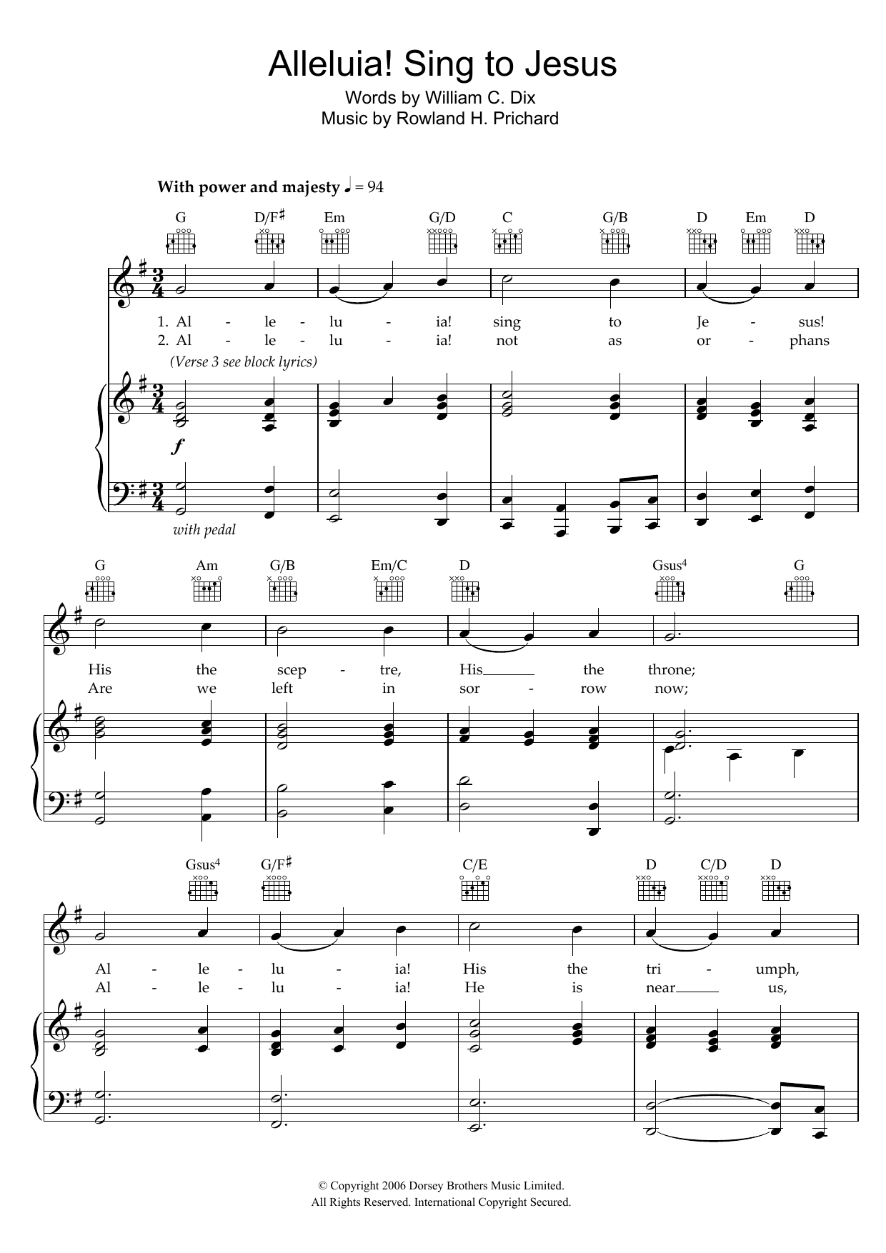 Learn to play William C. Dix Alleluya, Sing To Jesus sheet music for Piano, Vocal & Guitar Chords in minutes. Price: 7.8900$ William C. Dix Alleluya, Sing To Jesus sheet music notes and chords arranged for Piano, Vocal & Guitar Chords