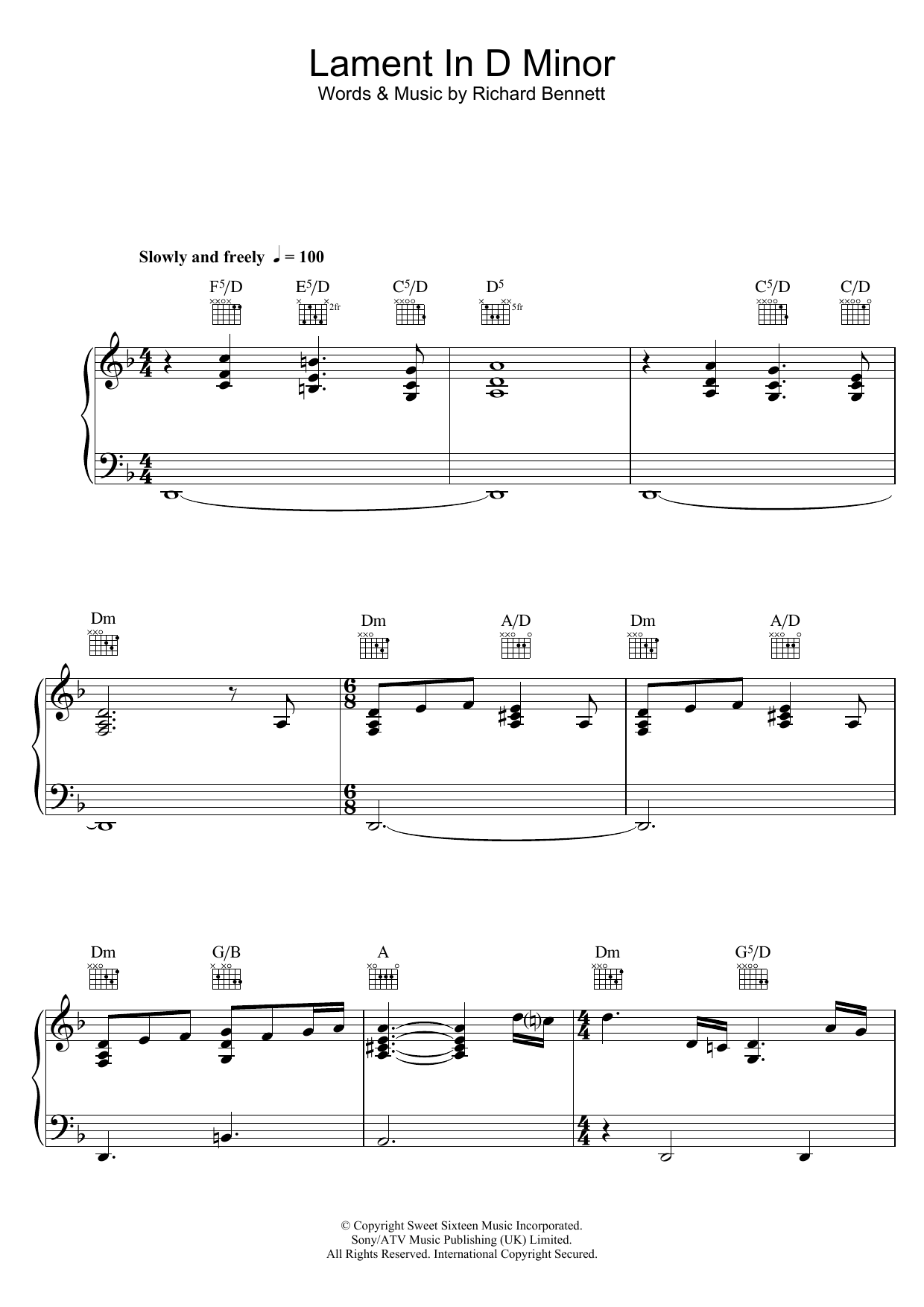 Learn to play Neil Diamond Lament In D Minor sheet music for Piano Solo in minutes. Neil Diamond Lament In D Minor sheet music notes and chords. Download Printable PDF.