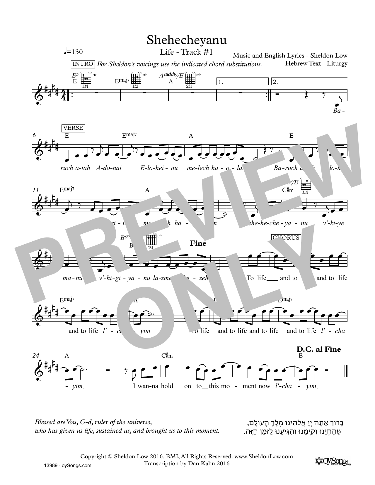 Learn to play Sheldon Low Shehecheyanu sheet music for Lead Sheet / Fake Book in minutes. Price: 5.9900$ Sheldon Low Shehecheyanu sheet music notes and chords arranged for Lead Sheet / Fake Book
