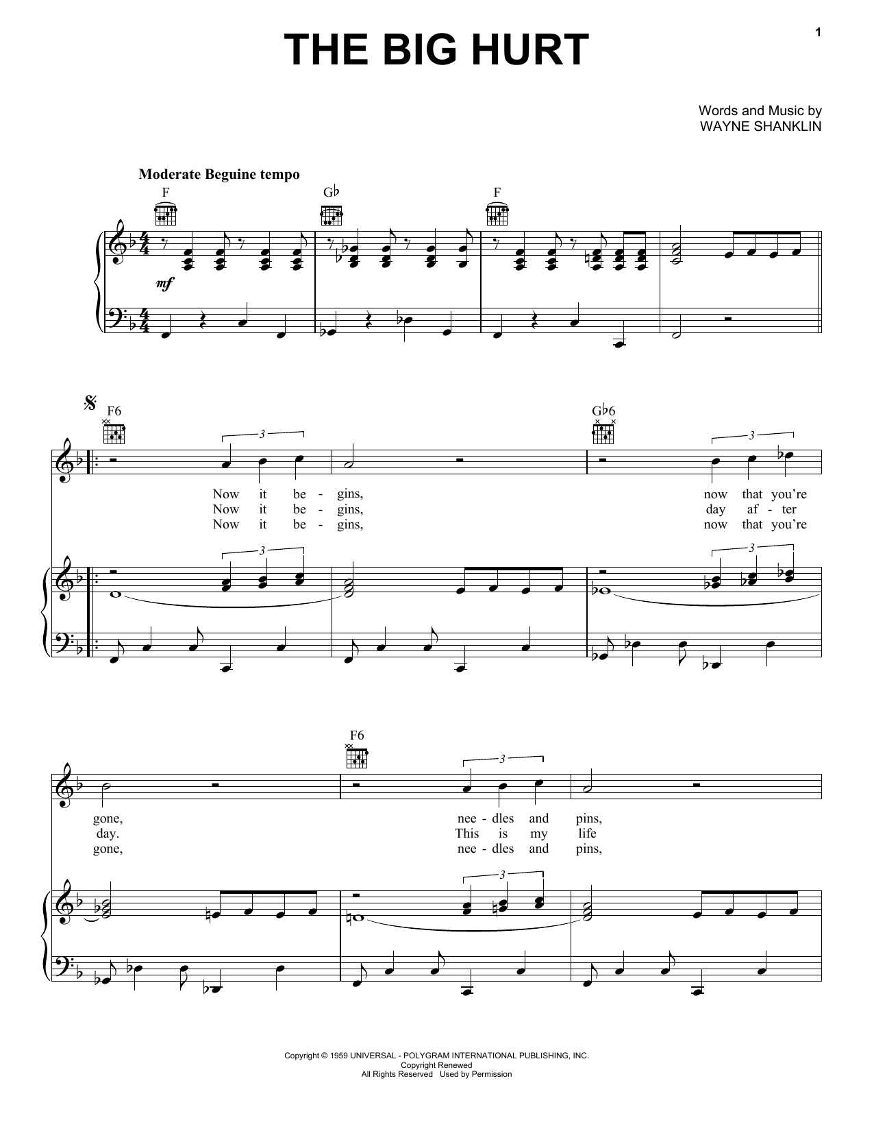 Toni Fisher The Big Hurt sheet music notes and chords. Download Printable PDF.